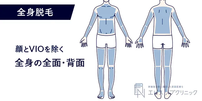 メンズの全身脱毛に含まれる範囲