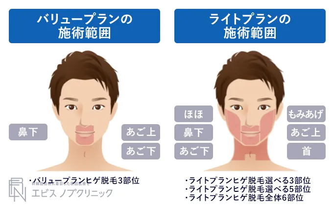 エミナルクリニックメンズヒゲ脱毛の施術範囲