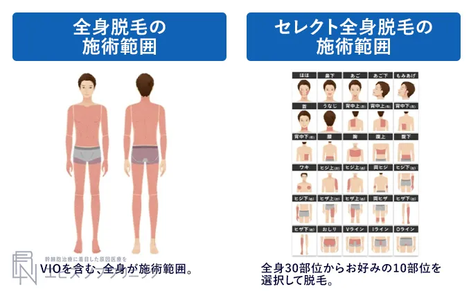 エミナルクリニックメンズ全身脱毛の施術範囲