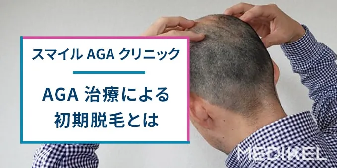 AGA治療の初期脱毛とは