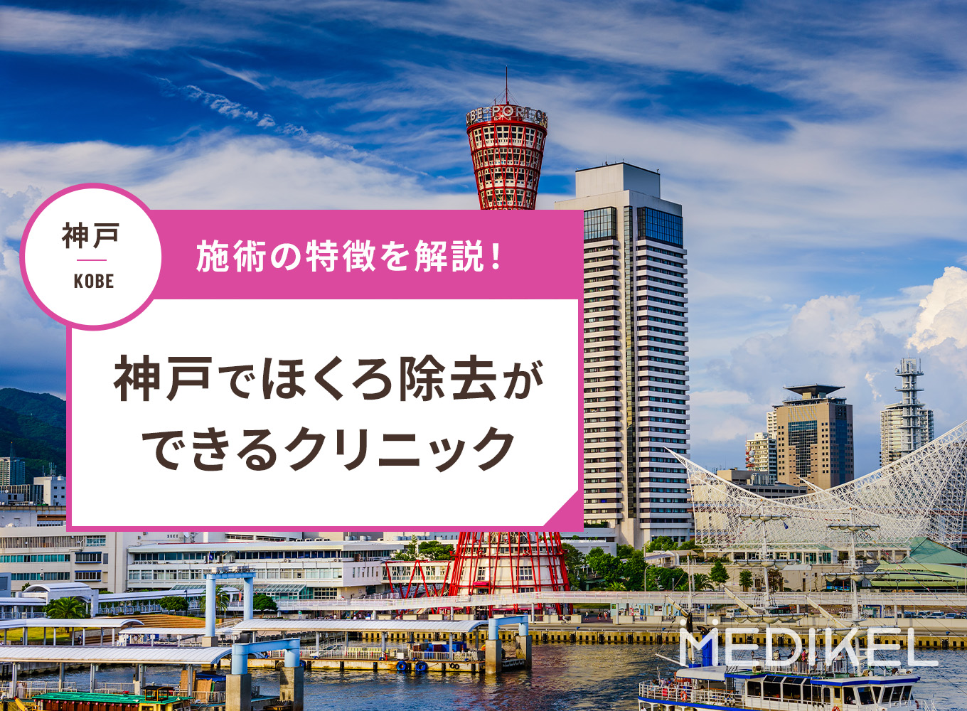 神戸でほくろ除去ができるおすすめクリニック！取り放題プランがあるのは？