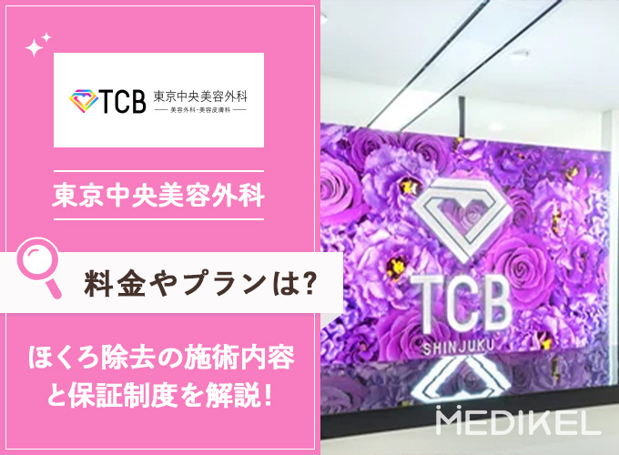 TCB東京中央美容外科のほくろ除去の料金と施術方法を紹介