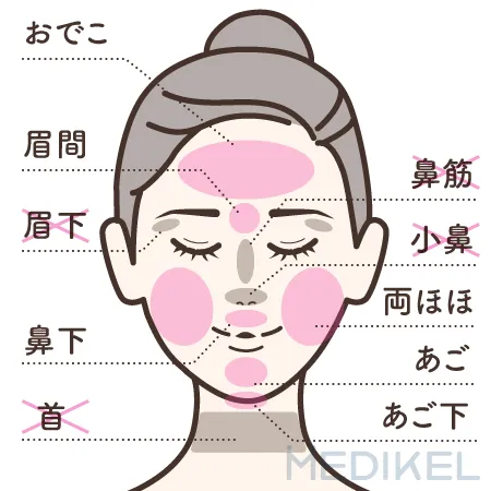 TCB東京中央美容外科の顔脱毛の施術範囲