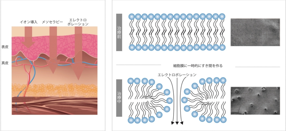 エレクトロポレーションとは