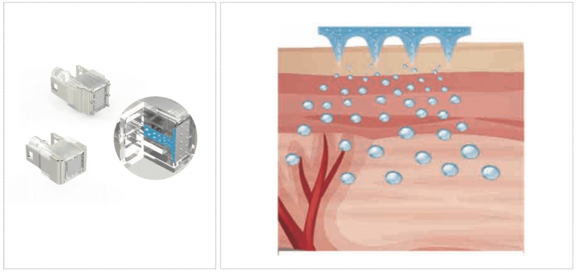 特許取得 マイクロチップとは