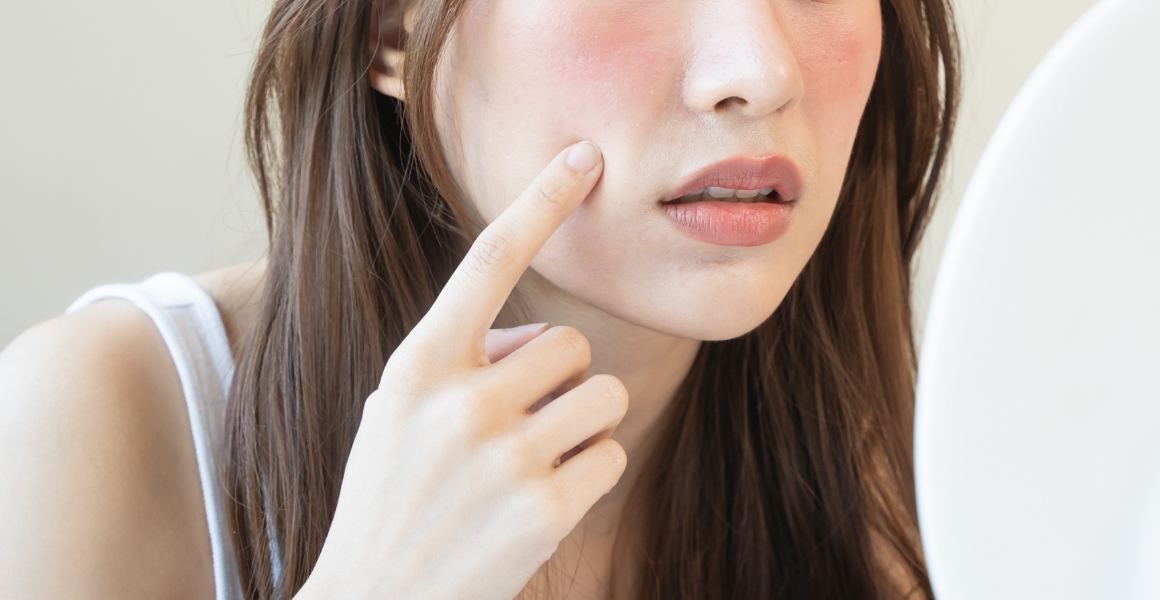 施術後の注意点