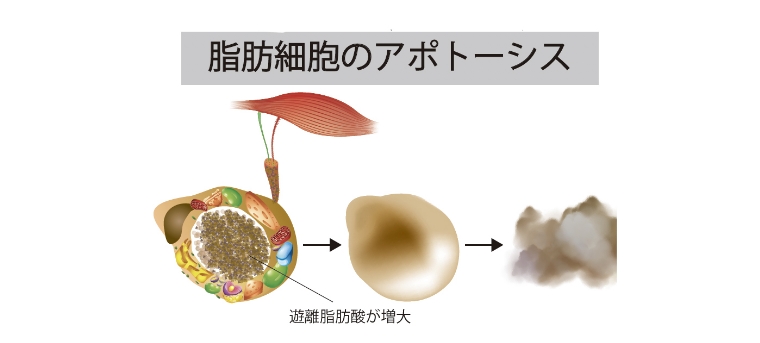 08｜脂肪分解＋脂肪細胞破壊